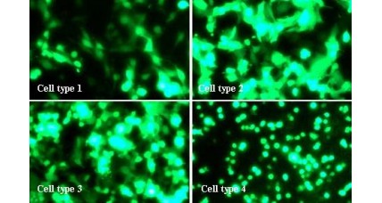 Transfection reagent for difficult cells: LipoMaxin